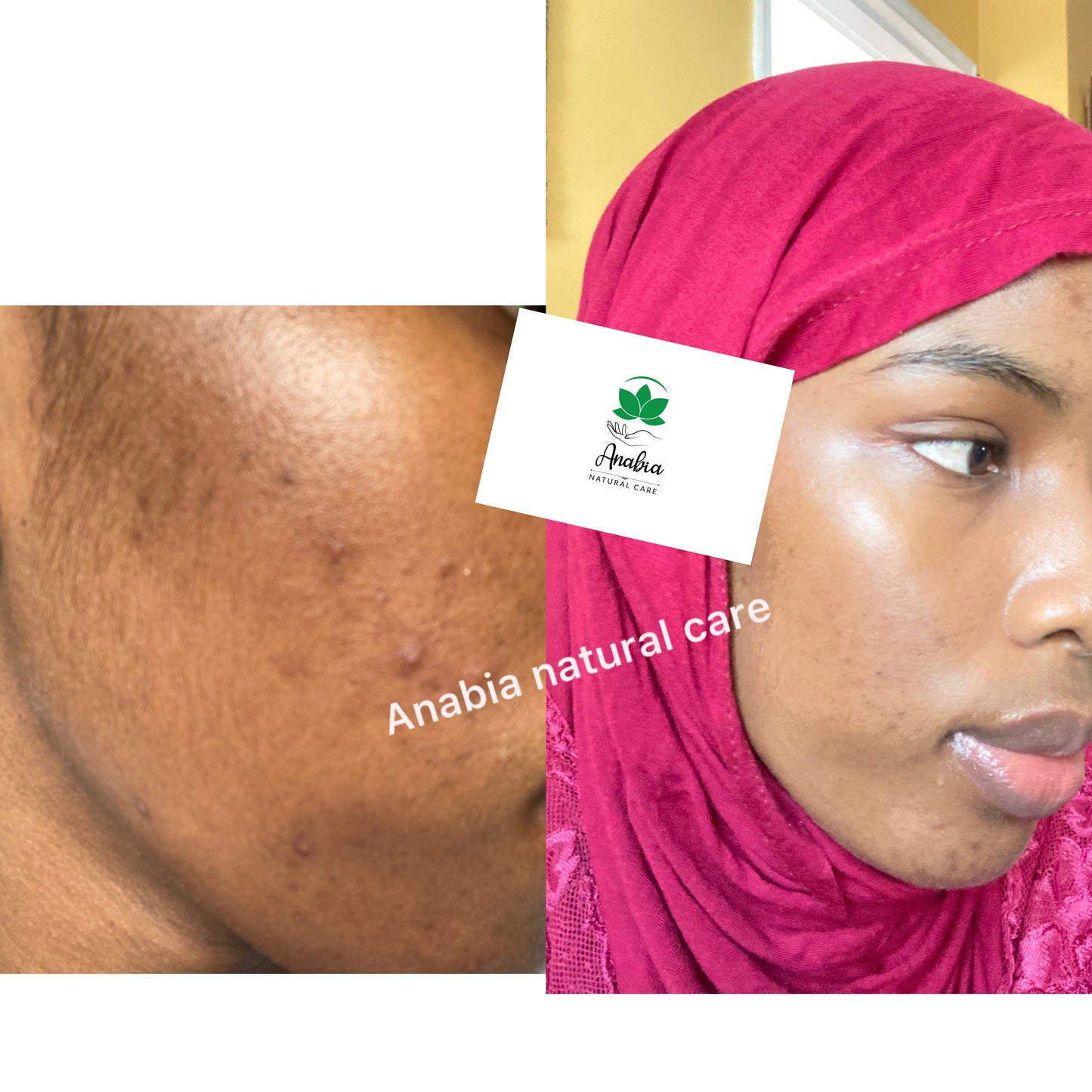 Dark spots & hyperpigmentation eraser bundle